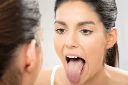 Tongue Changes