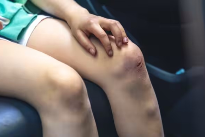 Wound Dressing Tips