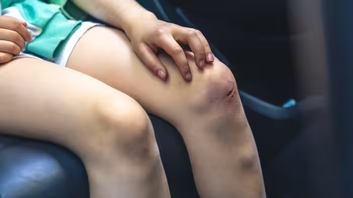 Wound Dressing Tips