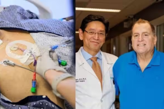Pig Kidney Transplant In Human Body