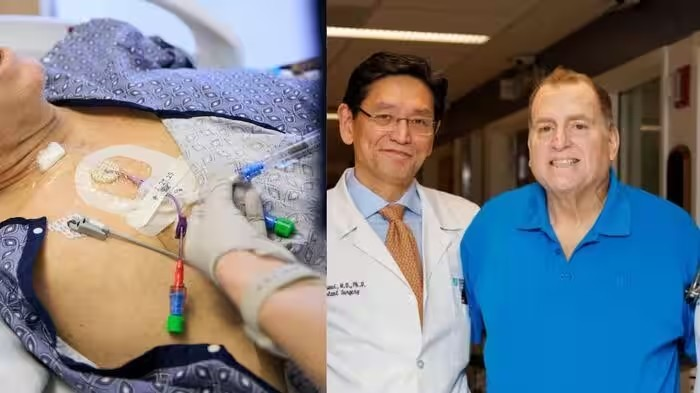 Pig Kidney Transplant In Human Body