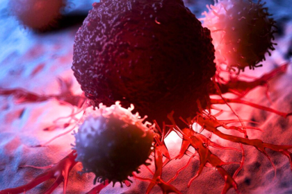 Cancer Symptoms
