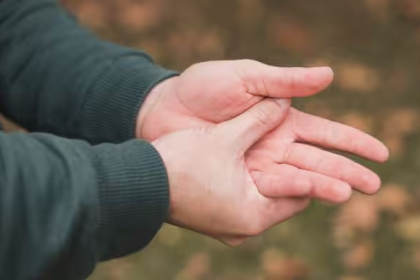 Hand Swelling