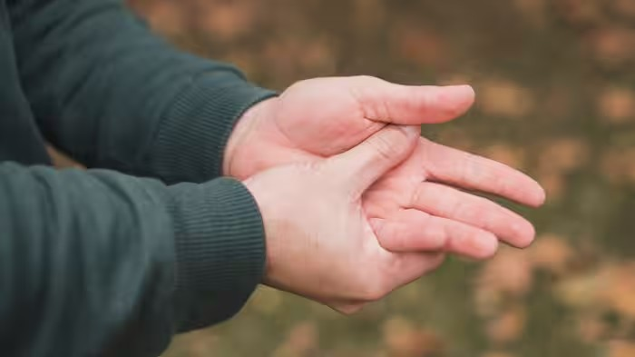 Hand Swelling
