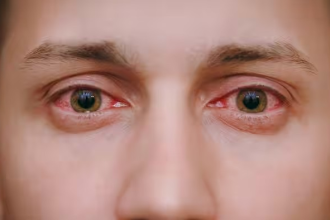 Eye Redness Causes