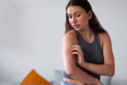 Mosquito Bite Skeeter Syndrome