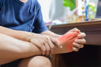 Uric Acid Gout Symptoms