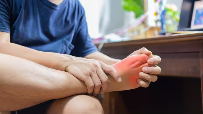 Uric Acid Gout Symptoms: ચાલતી વખતે પગમાં દુખાવો થાય છે? યુરિક એસિડ વધવાથી હોઈ શકે છે ગાઉટ, જાણો લક્ષણો અને કારણ 1 Uric Acid Gout Symptoms
