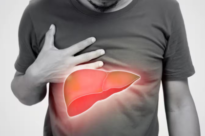  Fatty Liver Treatment