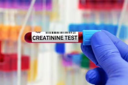 Creatinine Kidney Test