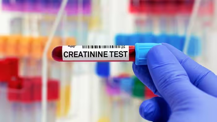 Creatinine Kidney Test