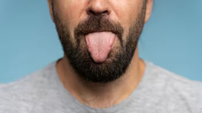 Yellow Tongue Causes