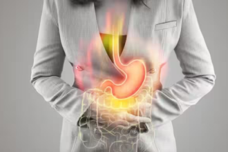 Gas After Gallbladder Removal